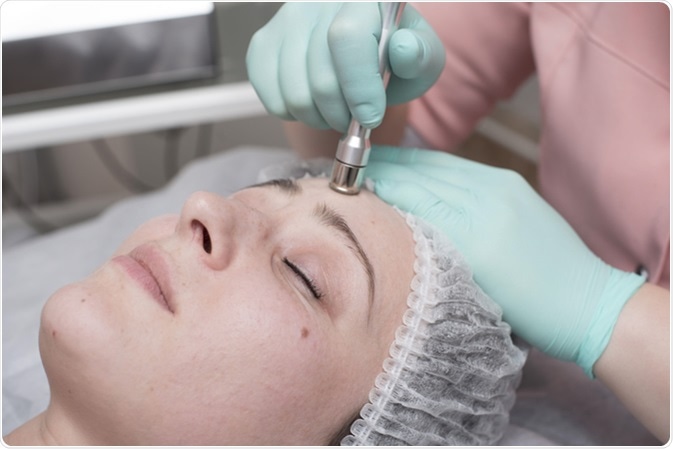 Facial dermabrasion. Image Credit: Vita Sun / Shutterstock